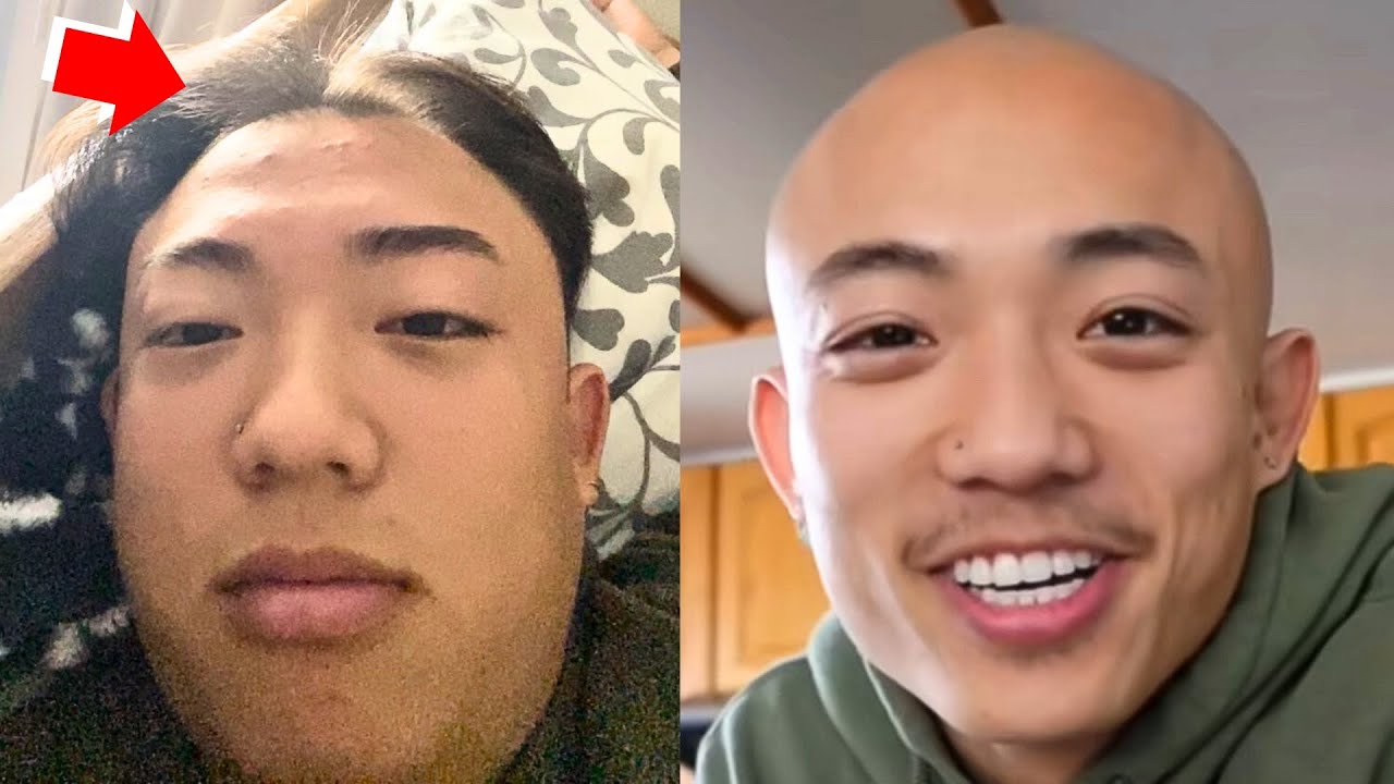 How BALDING Ruined My Life (Almost)