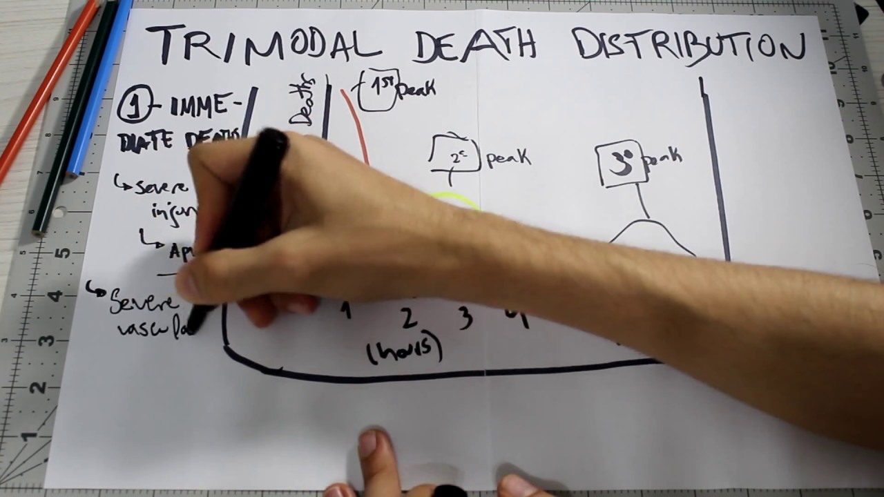 Trauma Trimodal Distribution of Death