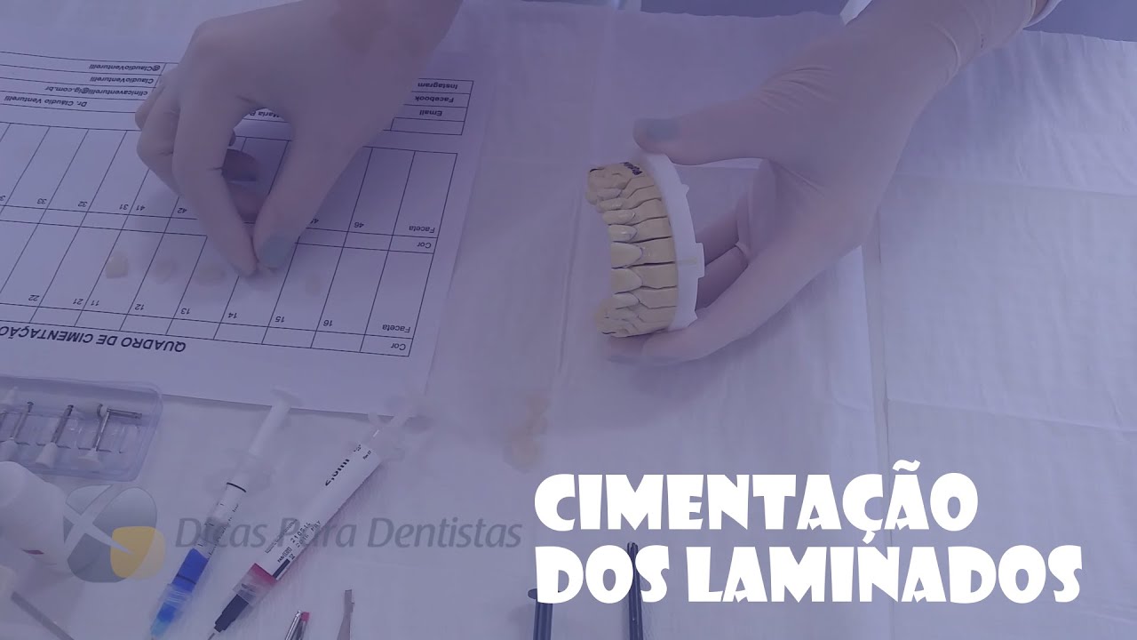 Cimentação dos Laminados Cerâmicos