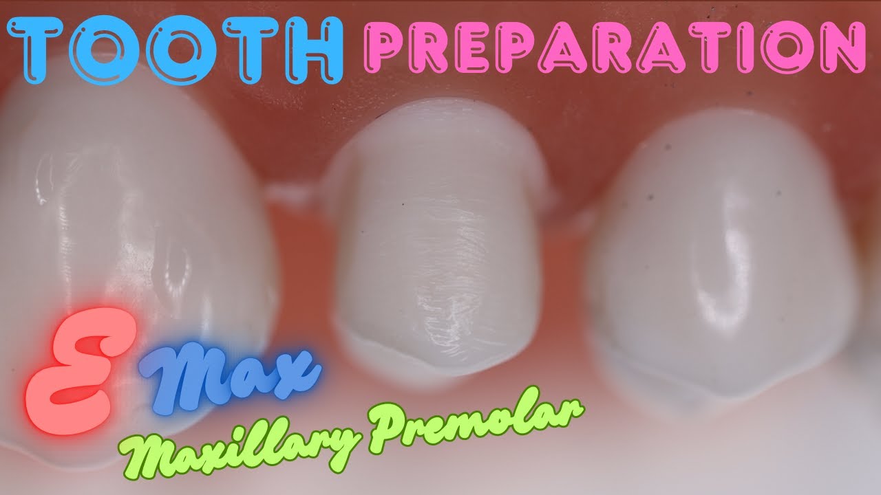 Tooth Preparation for Emax Crown on Maxillary First Premolar 🟡 Step By Step