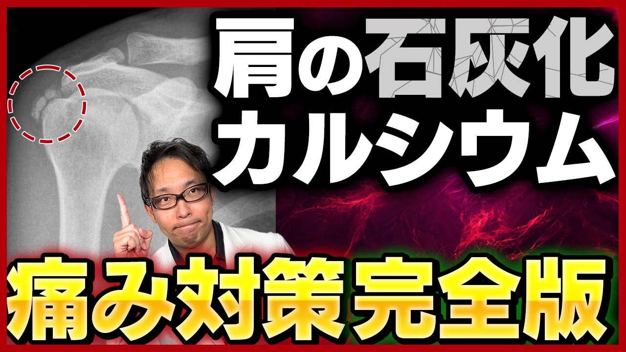 【完全版】石灰沈着性腱板炎の治療【手術・ストレッチ・衝撃波】