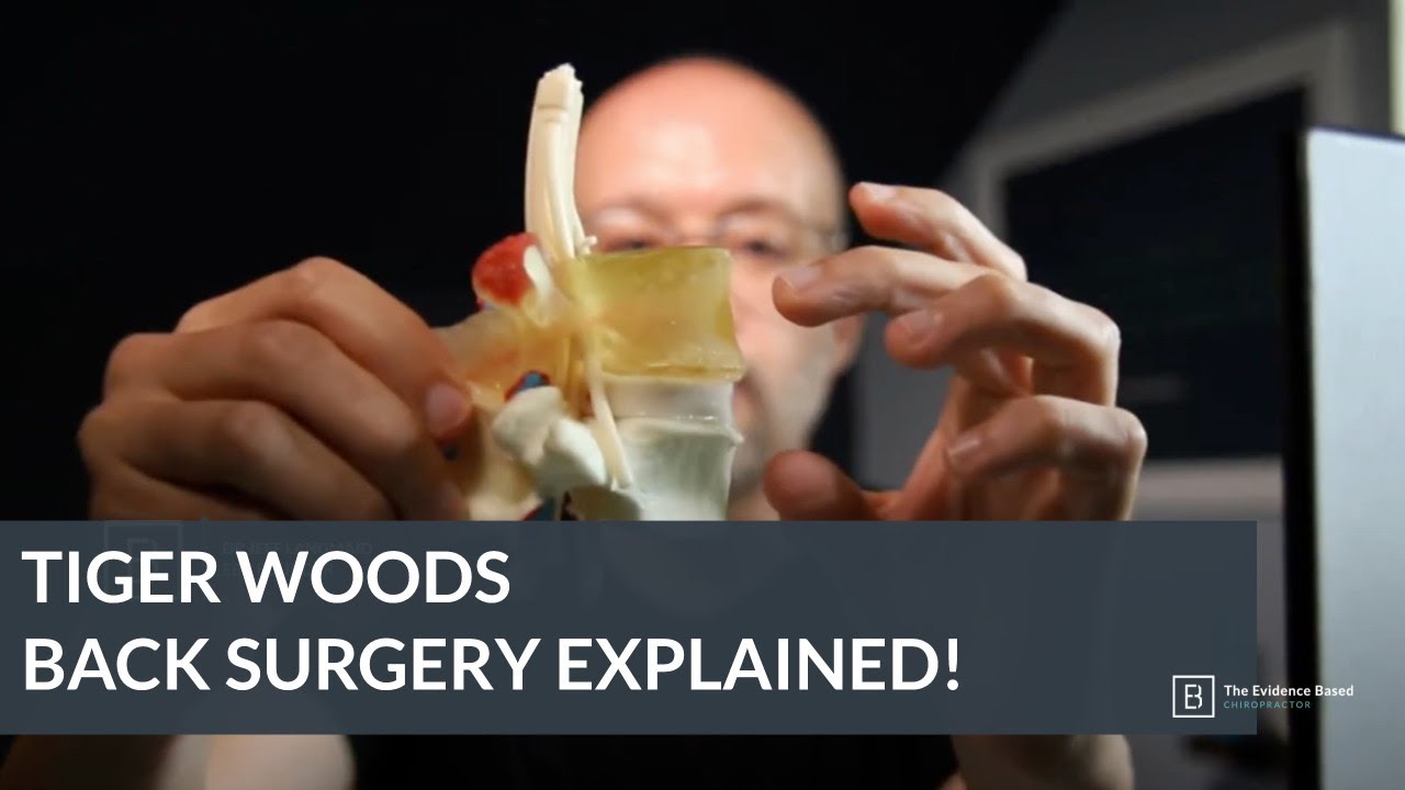 Tiger Woods Back Surgery Explained!