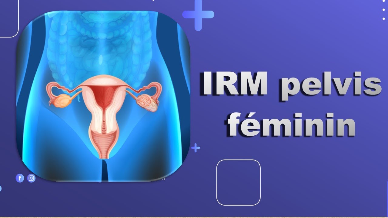 IRM pelvis féminin -Bonne Pratique_