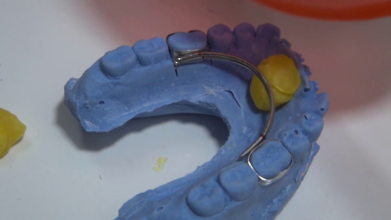 ARCO LINGUAL DE PUMA (ALP)  LABORATORIO