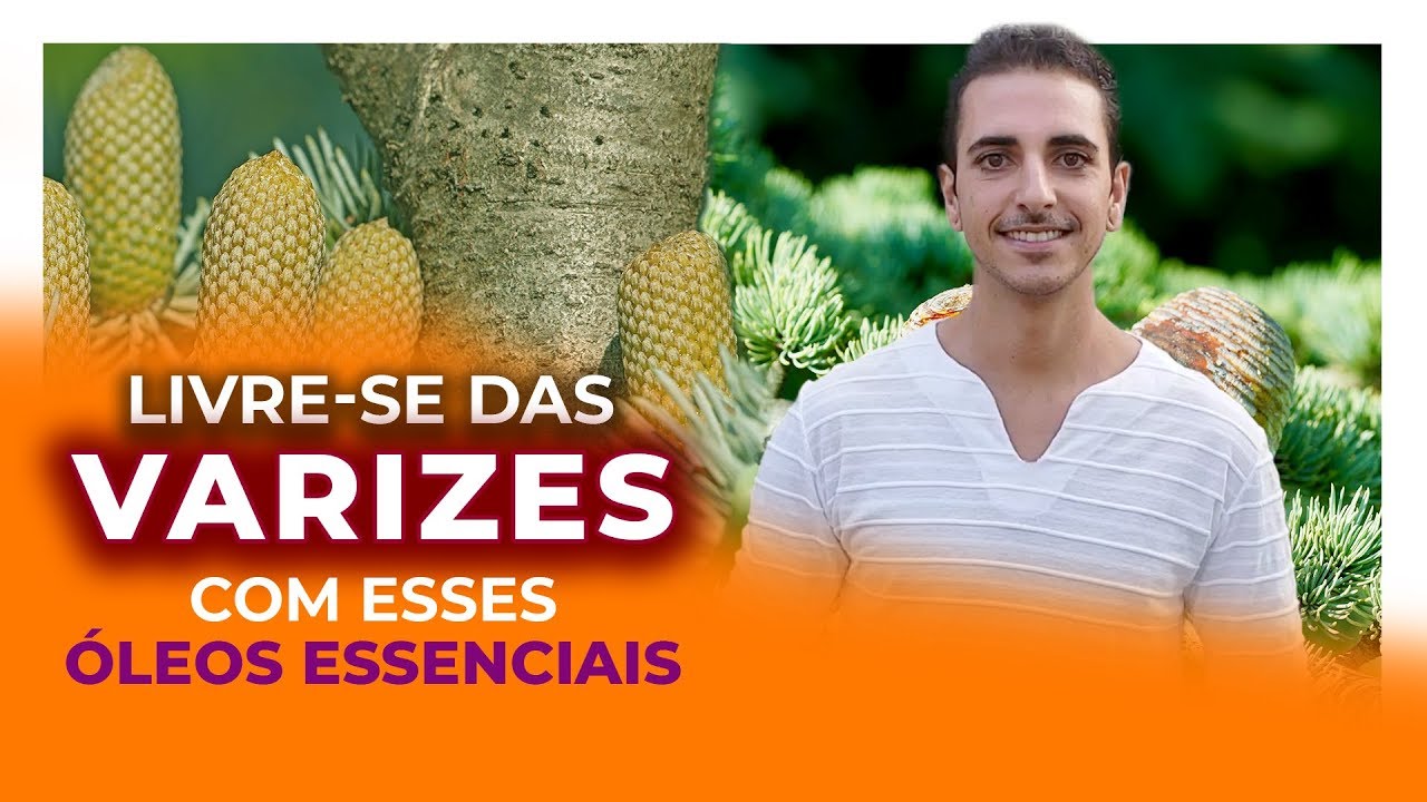 Como ACABAR com as VARIZES de forma SIMPLES e NATURAL!
