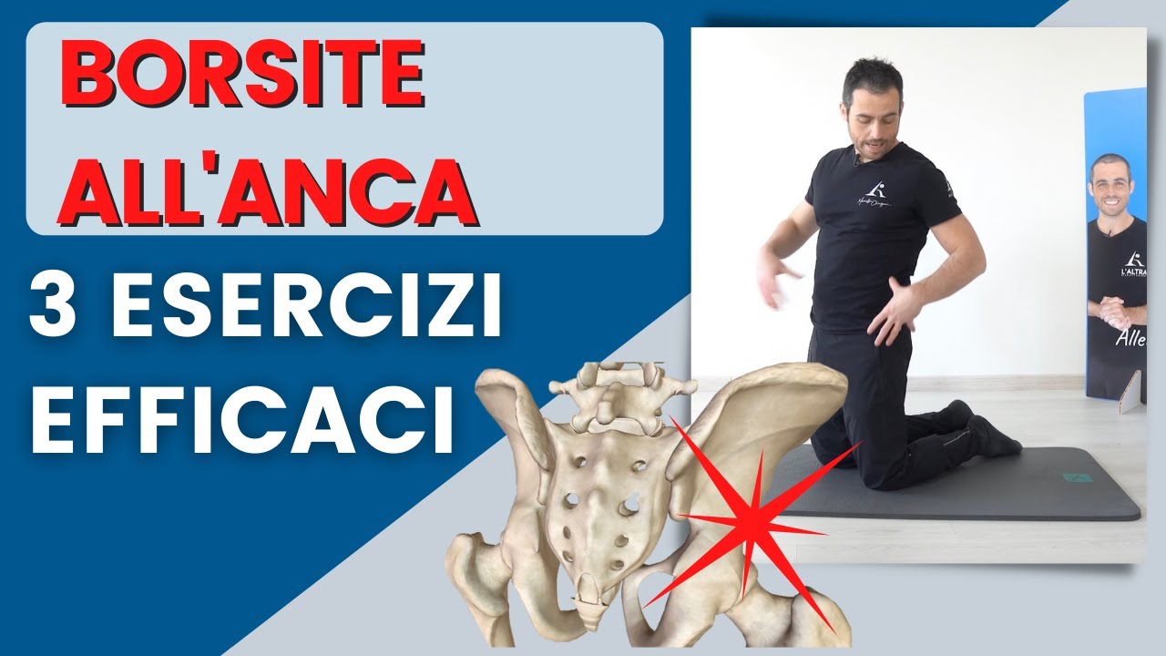 Borsite all'anca: esercizi per risolvere il dolore