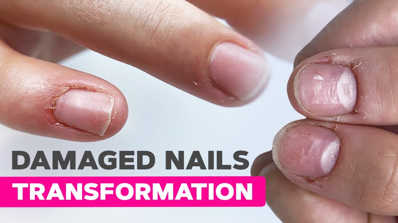 The BEST Nail Transformation Strategy Nobody Tells You | Dual Form Nail Extensions
