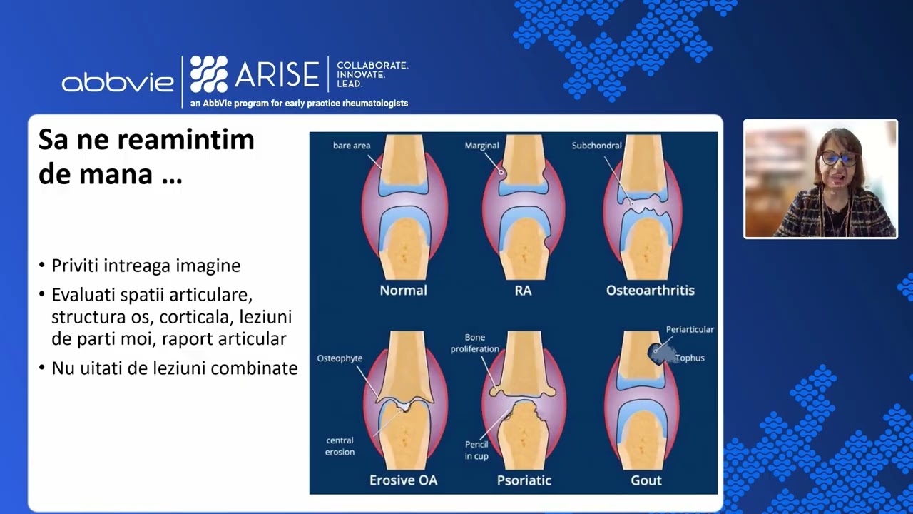 Abbvie   Imagistica musculo scheletala si articulara   13 November 2025