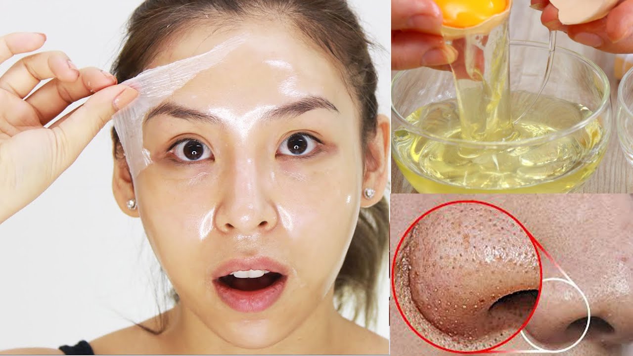 Egg White Face Mask |បំបាត់មុនក្បាលខ្មៅ| DIY Face Mask For Loose Skin, Skin Tightening & Open Pores