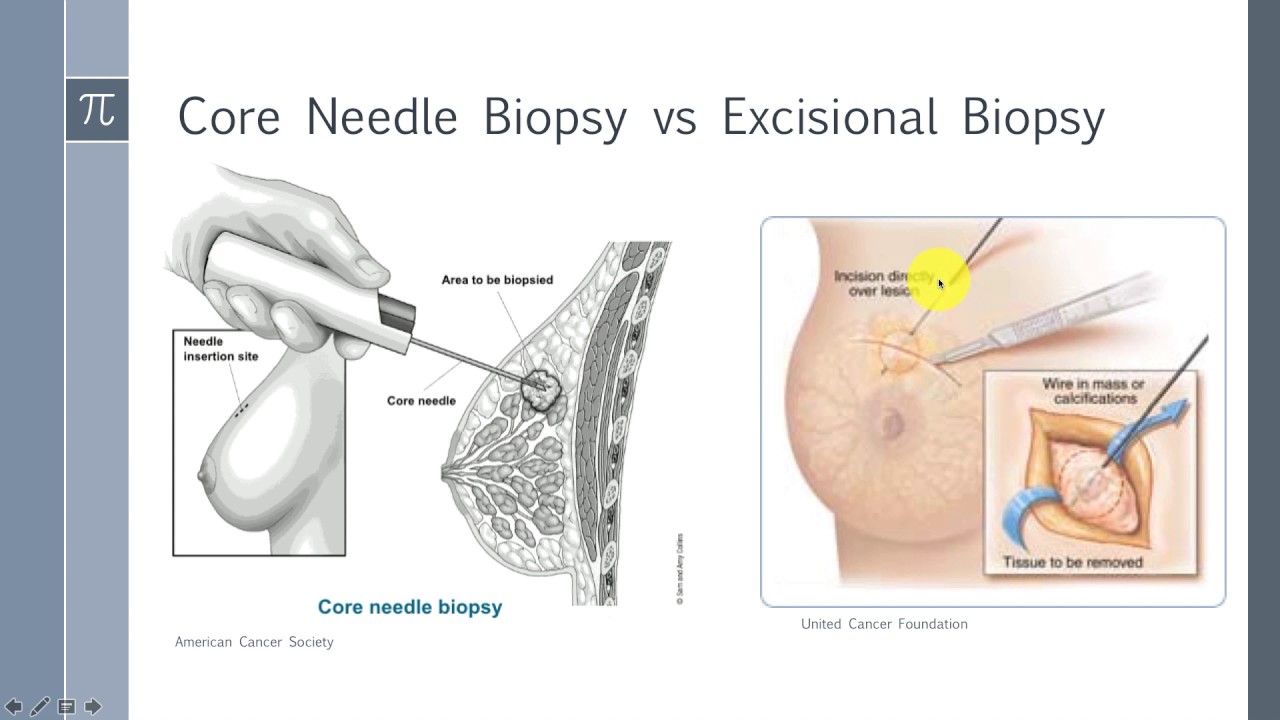 Breast Pathology and Surgery: Surgery Shelf