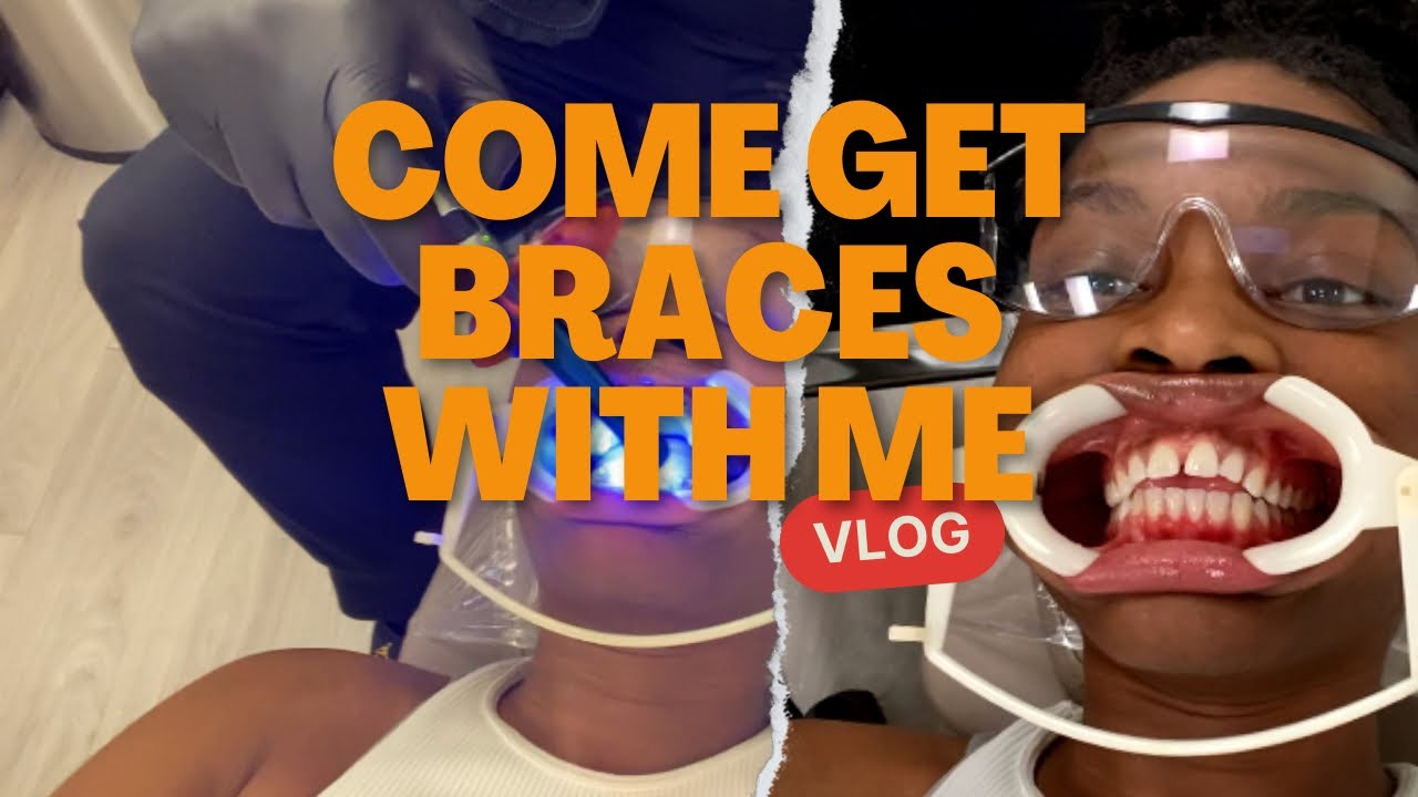 Braces vlog|Come get braces with me |Do they hurt?