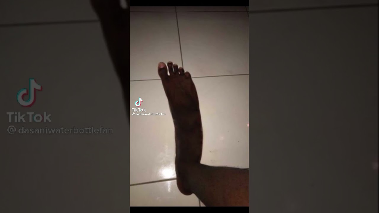 Black feet