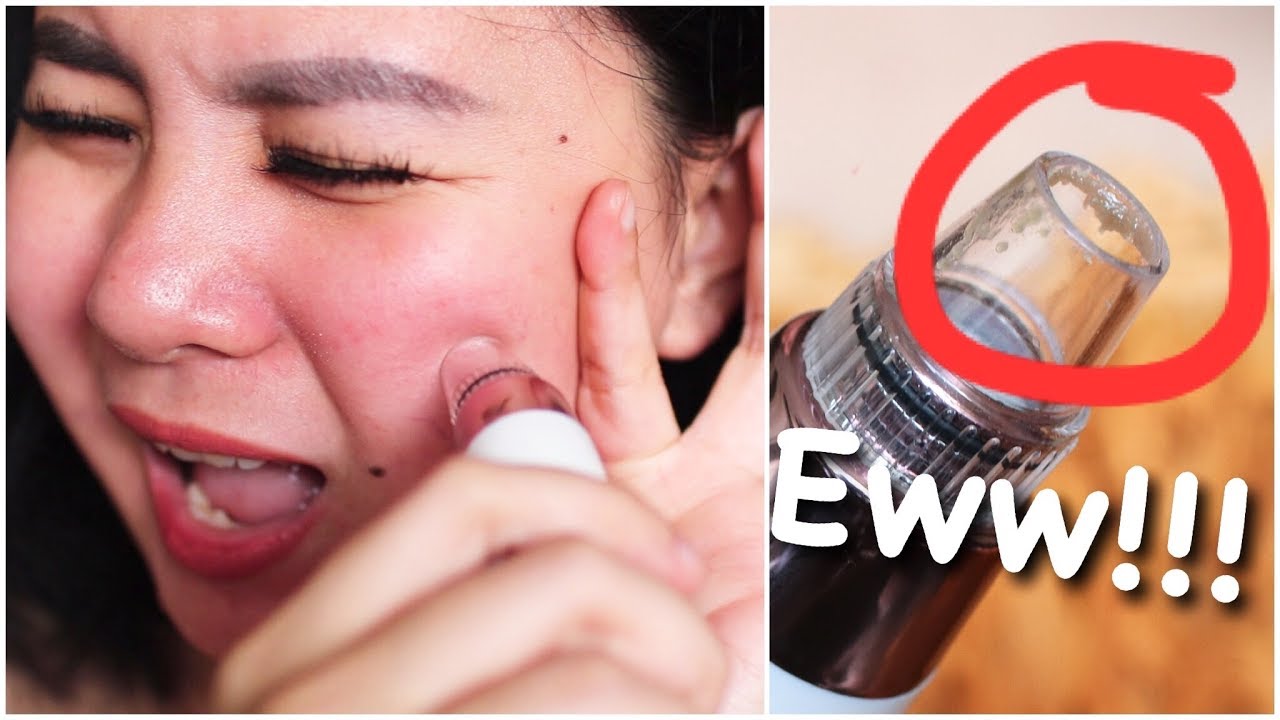 Blackhead Remover / Pore Vacuum Review | Does It Really Work??? | Kate Bladon