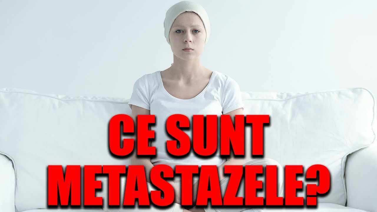 Ce sunt metastazele? Dr. Teodor Buliga răspunde