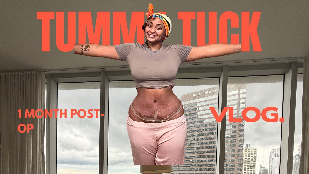 One month post op! Scar tape application + vlog 