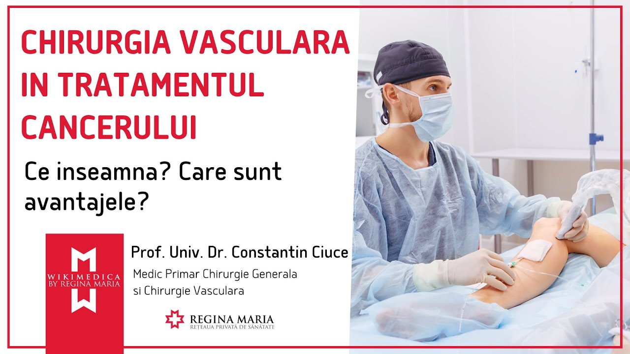 Chirurgie Vasculara: 2 Tehnici Moderne pentru Tratamentul Cancerului