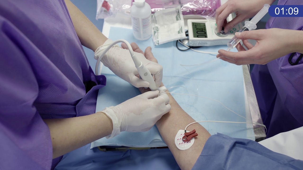 Pôle de chirurgie de la main - Le parcours patient