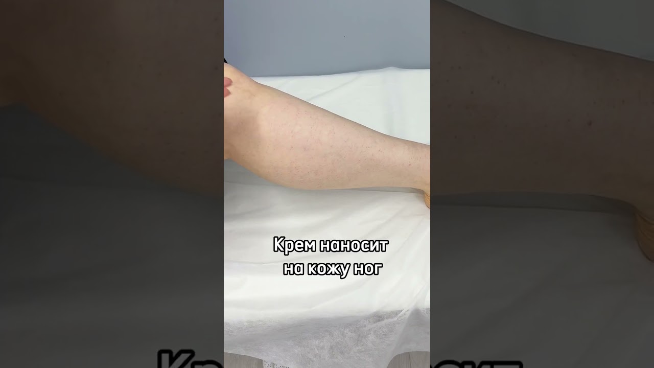 Мазь от варикоза. Флеболог Москва.