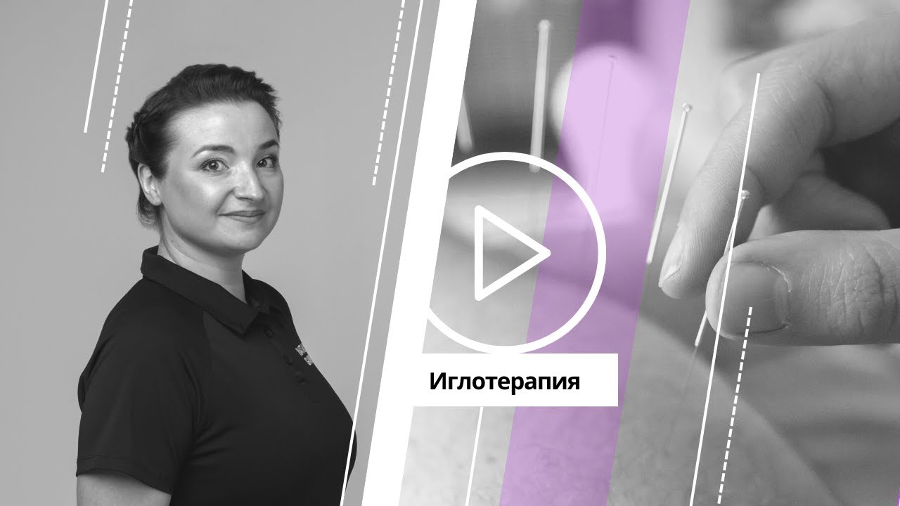 Игло­терапия| Dry Needling| Что это такое?