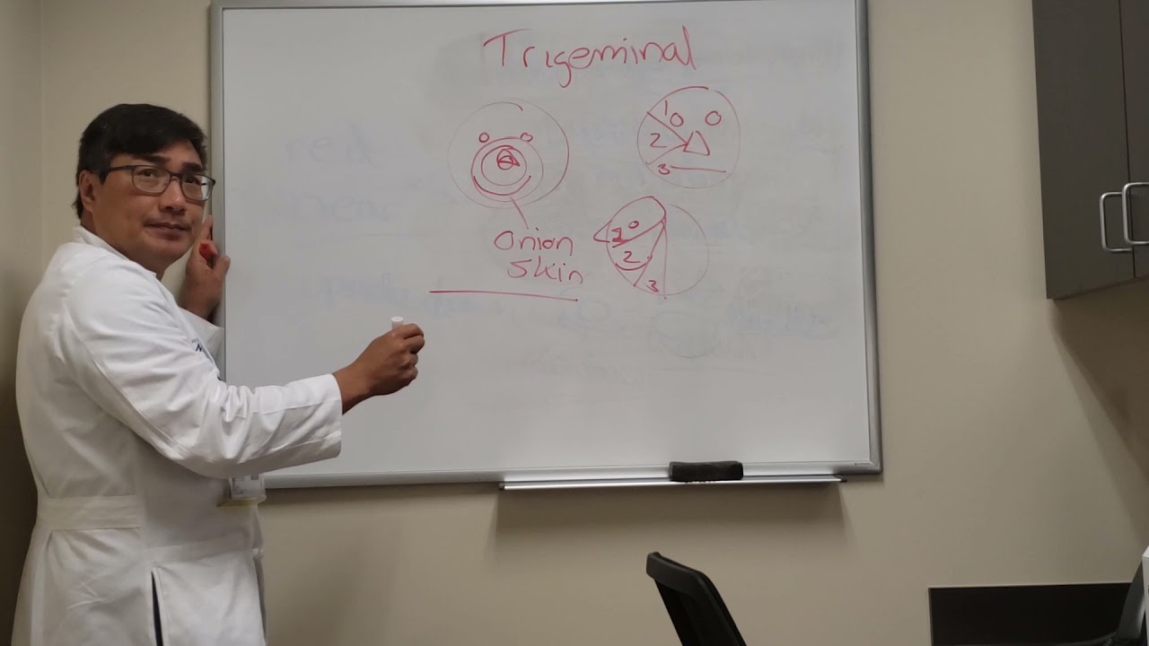Trigeminal Distribution Sensory Numbness