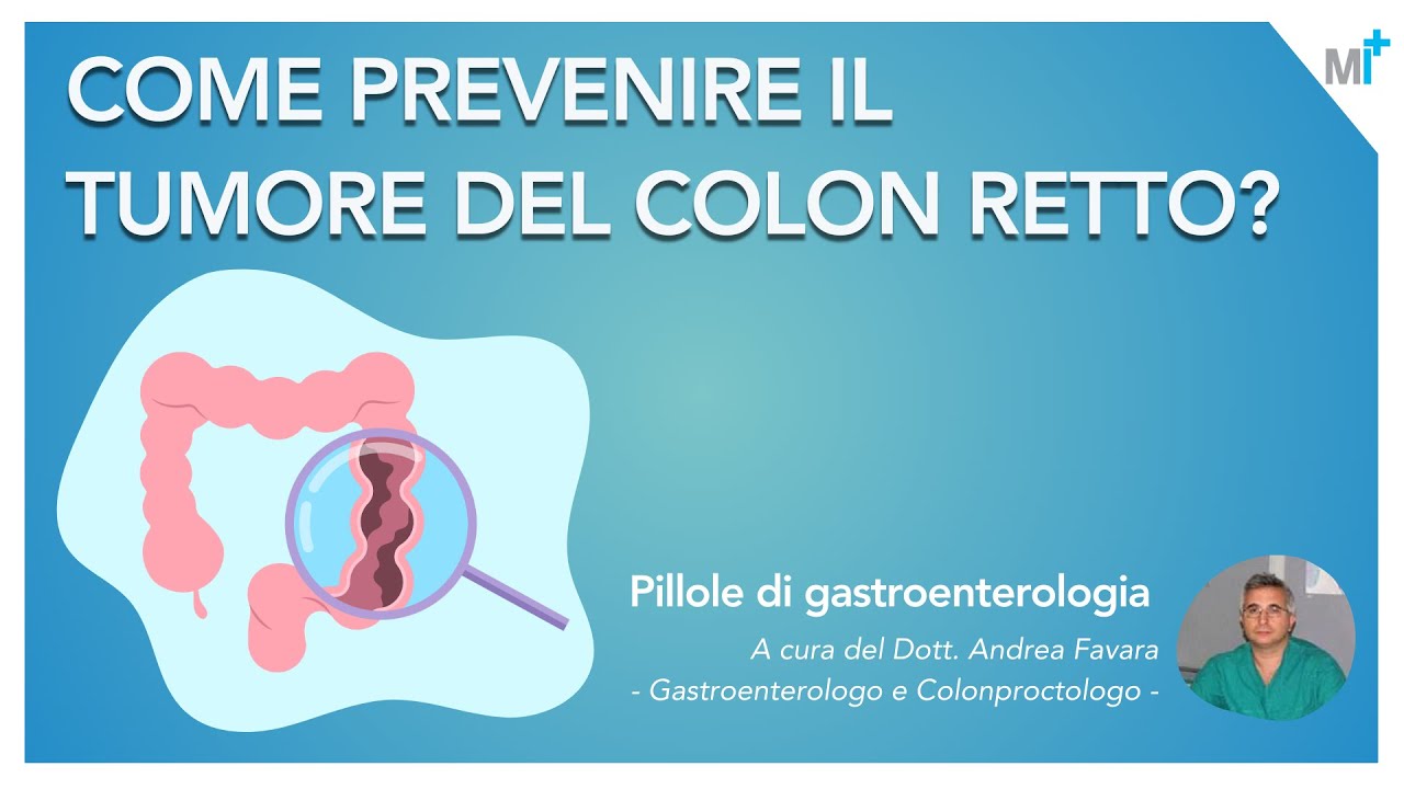 Tumore del colon retto: prevenzione, diagnosi e cura - video dott. Andrea Favara, gastroenterologo
