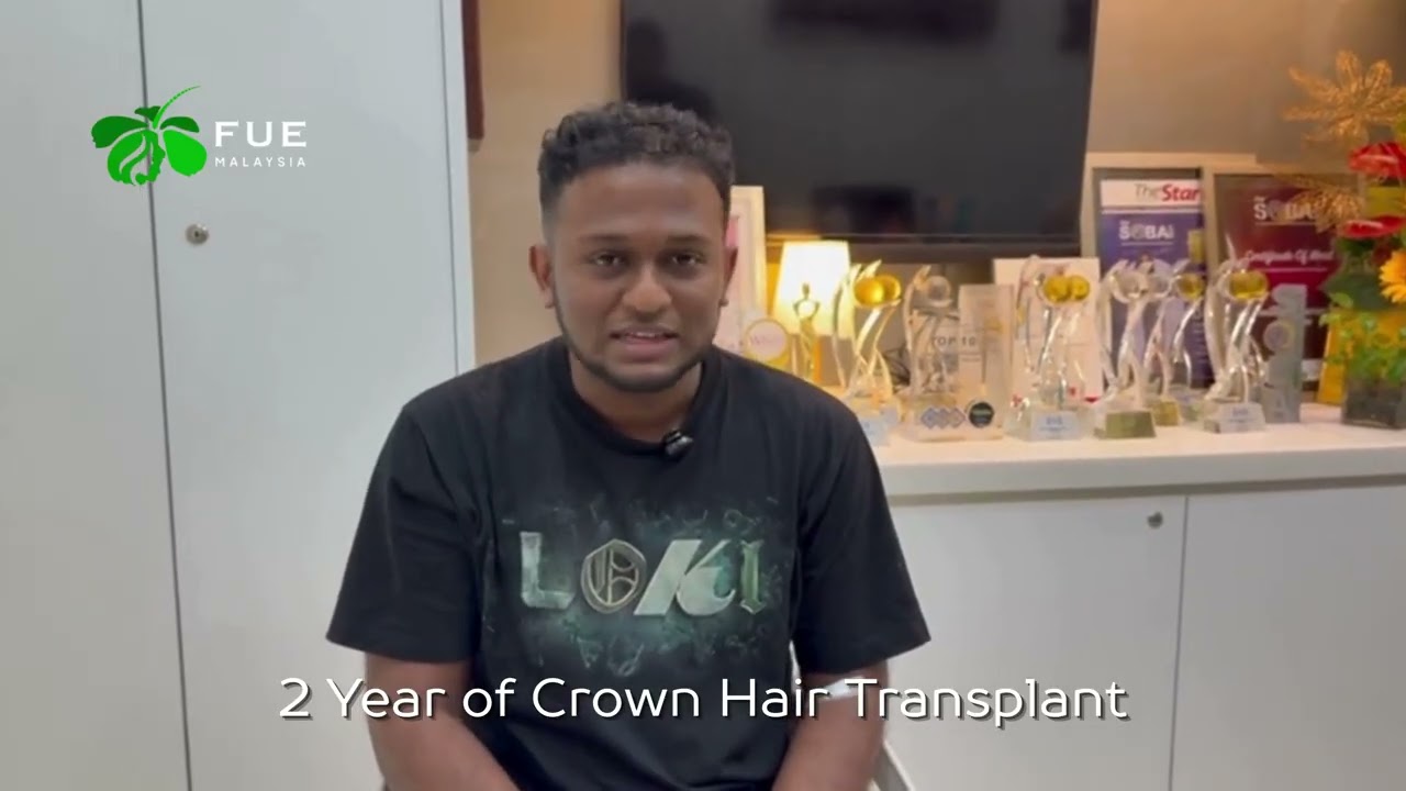 2 Years Hair Transplant Transformation - 𝑭𝑼𝑬 𝑯𝒂𝒊𝒓 𝑻𝒓𝒂𝒏𝒔𝒑𝒍𝒂𝒏𝒕 𝑴𝒂𝒍𝒂𝒚𝒔𝒊𝒂.