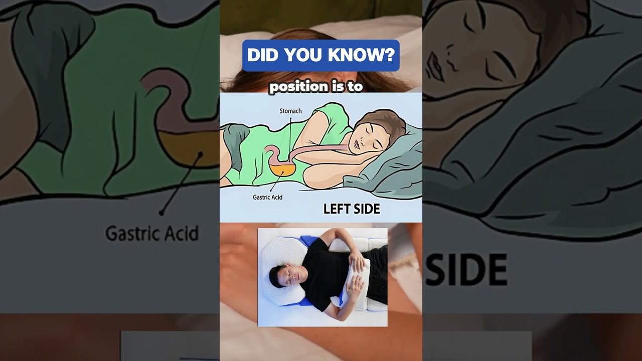 The 2 Worst Sleep Positions For Acid Reflux (And The 1 That Actually Helps) 🔥