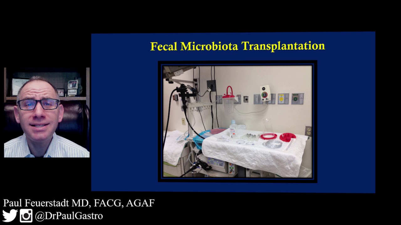How do we perform FMT? (Patients)
