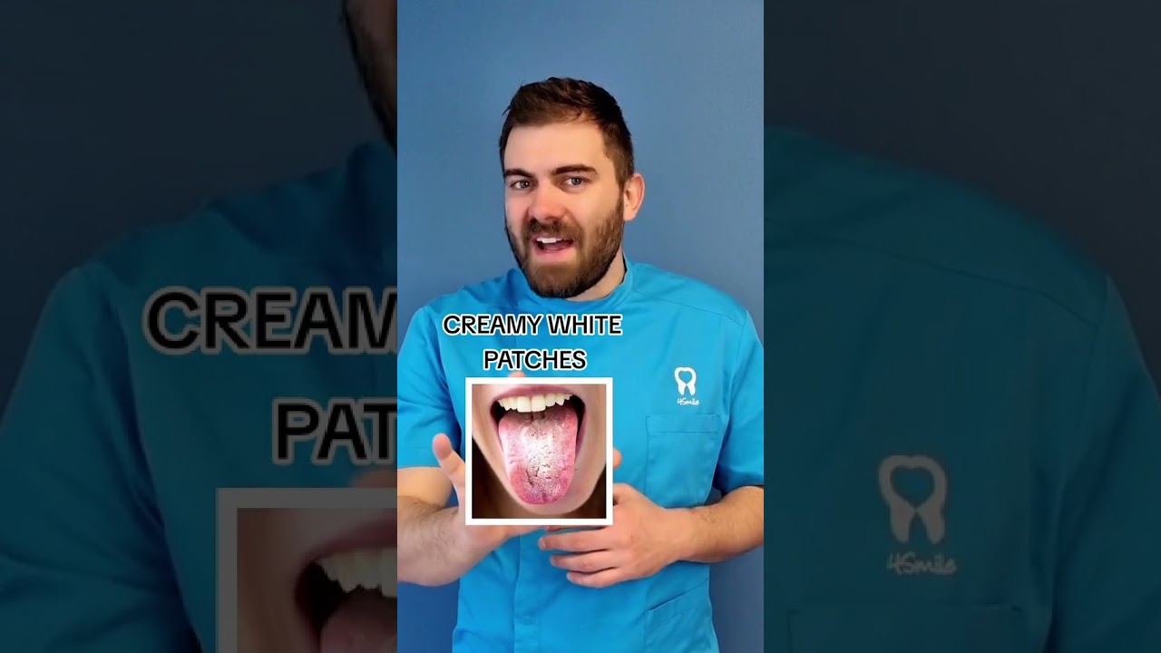 What can dentist tell by looking at your tongue?