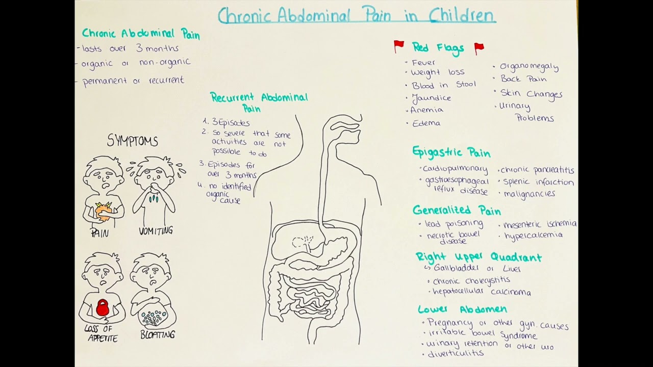 chronic abdominal pain in children