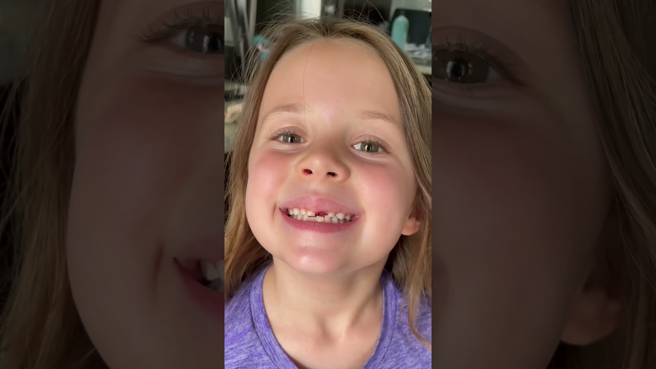 You won&rsquo;t believe how her tooth came out! #shorts #amazing #themccartys