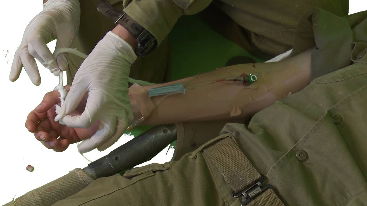 כיצד לקבע סט