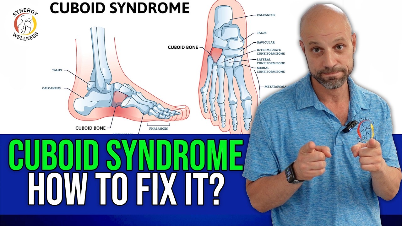 I Healed My Cuboid Syndrome with This ONE Trick