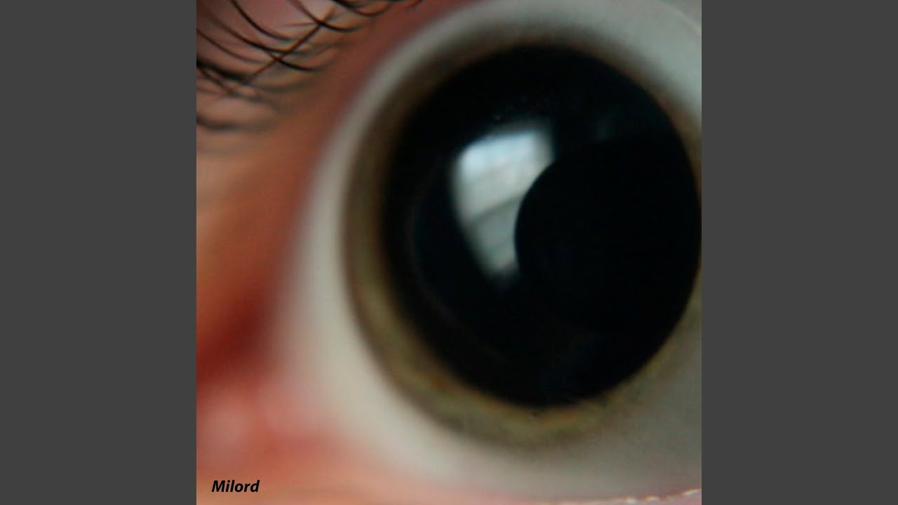 Conceal