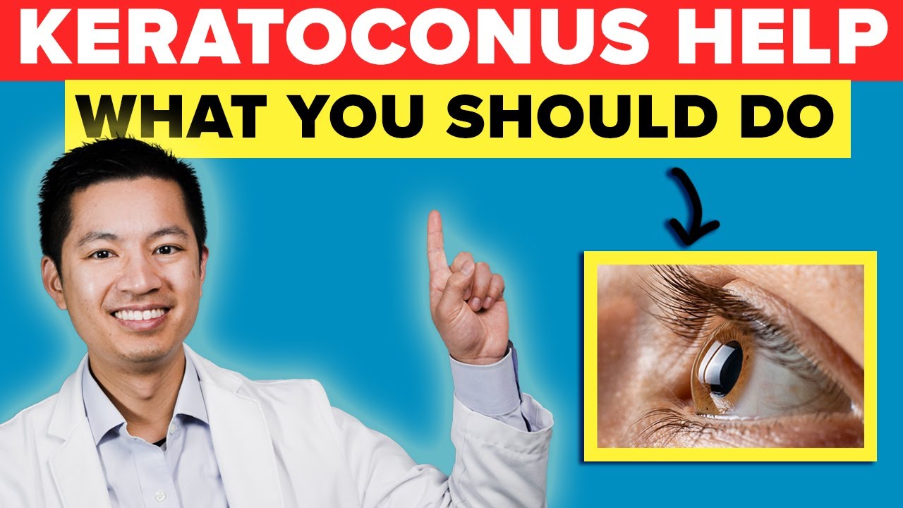 What Should You Do If You Have Keratoconus!