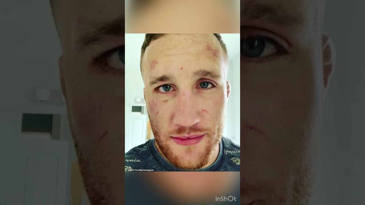 5 most overrated UFC FIGHTERS 