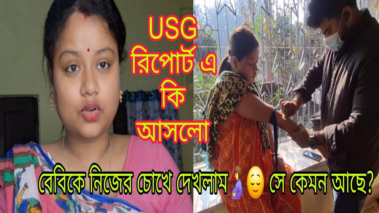 USG রিপোর্টে কি আসলো ?আমার বেবি কেমন আছে এখন?// প্রথমবার এমন অভিজ্ঞতা হলো আমার।
