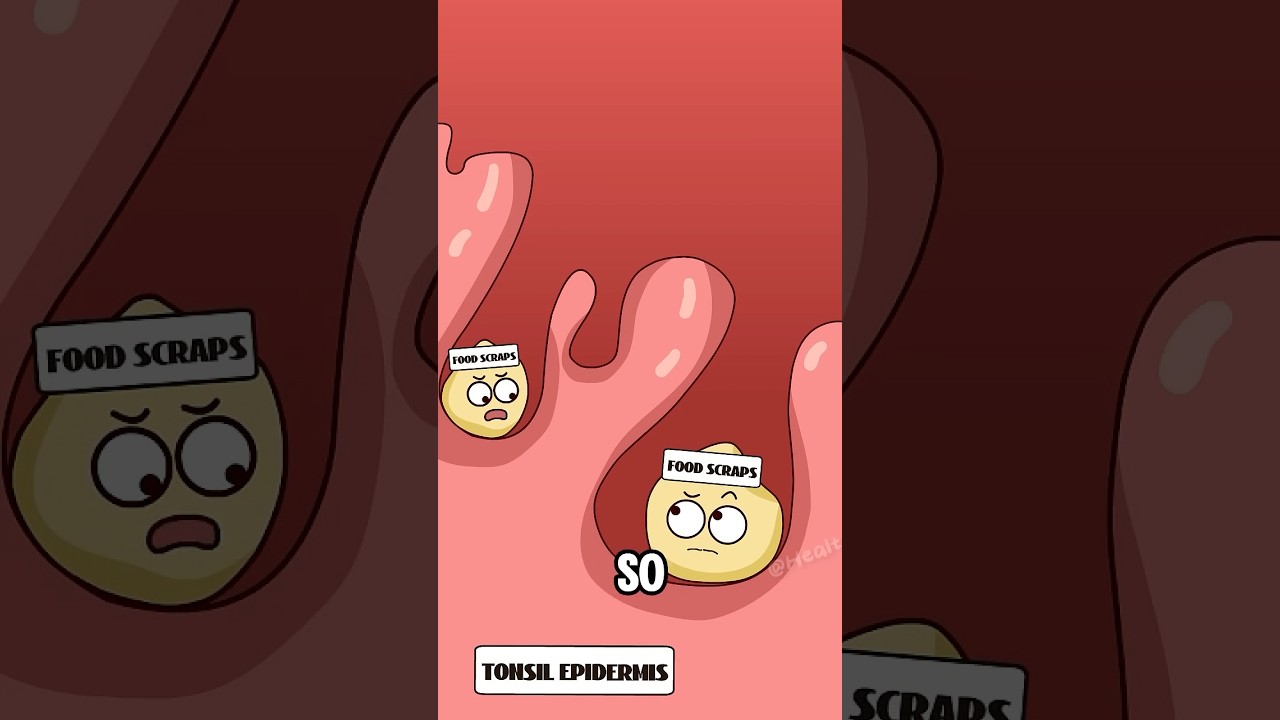 What are those smelly particles that you pick out of your throat?#shorts