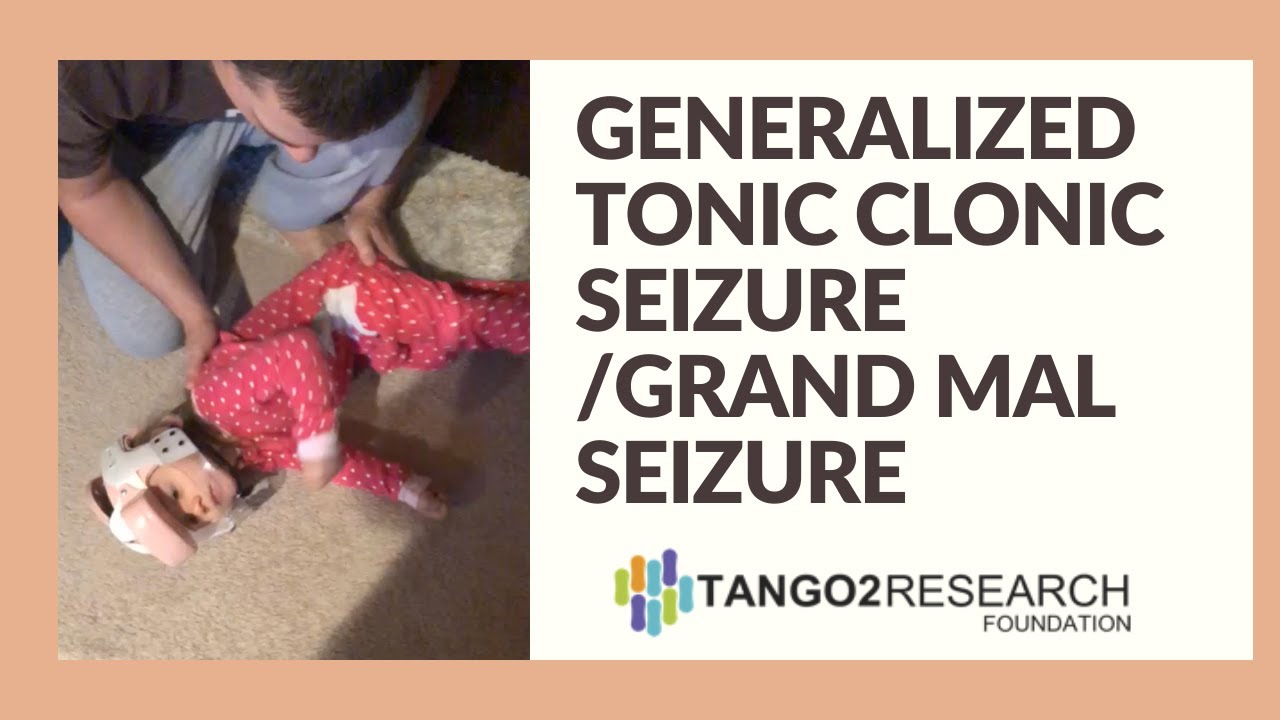 Generalized Tonic Clonic Seizure / Grand Mal Seizure