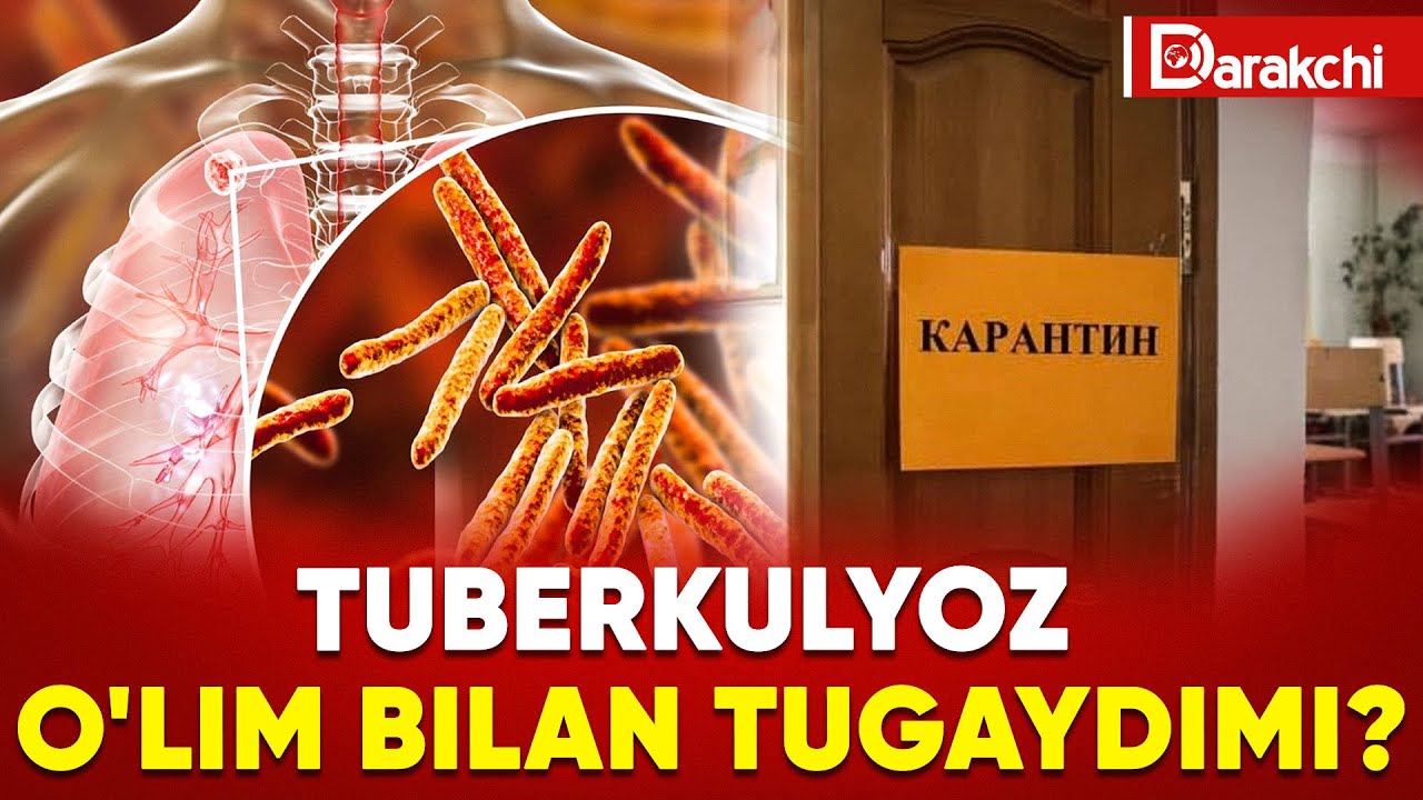 TUBERKULYOZ O'LIM BILAN TUGAYDIMI?