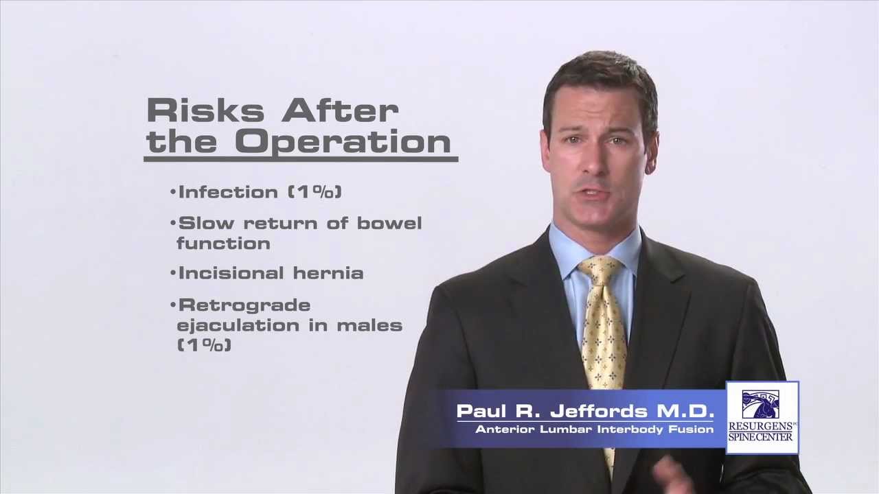 ALIF - Anterior Lumbar Interbody Fusion