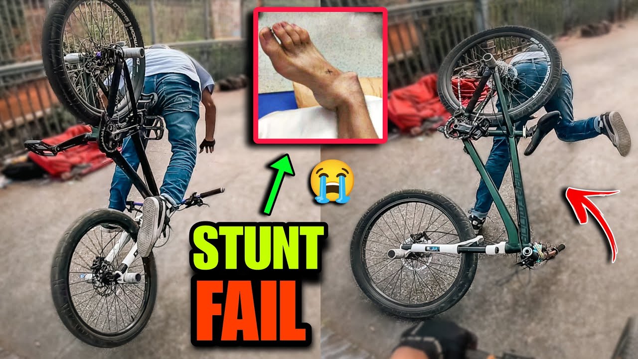 EPIC STUNT FAIL | Shocking Leg Break! | Cycle Stunt Challenge