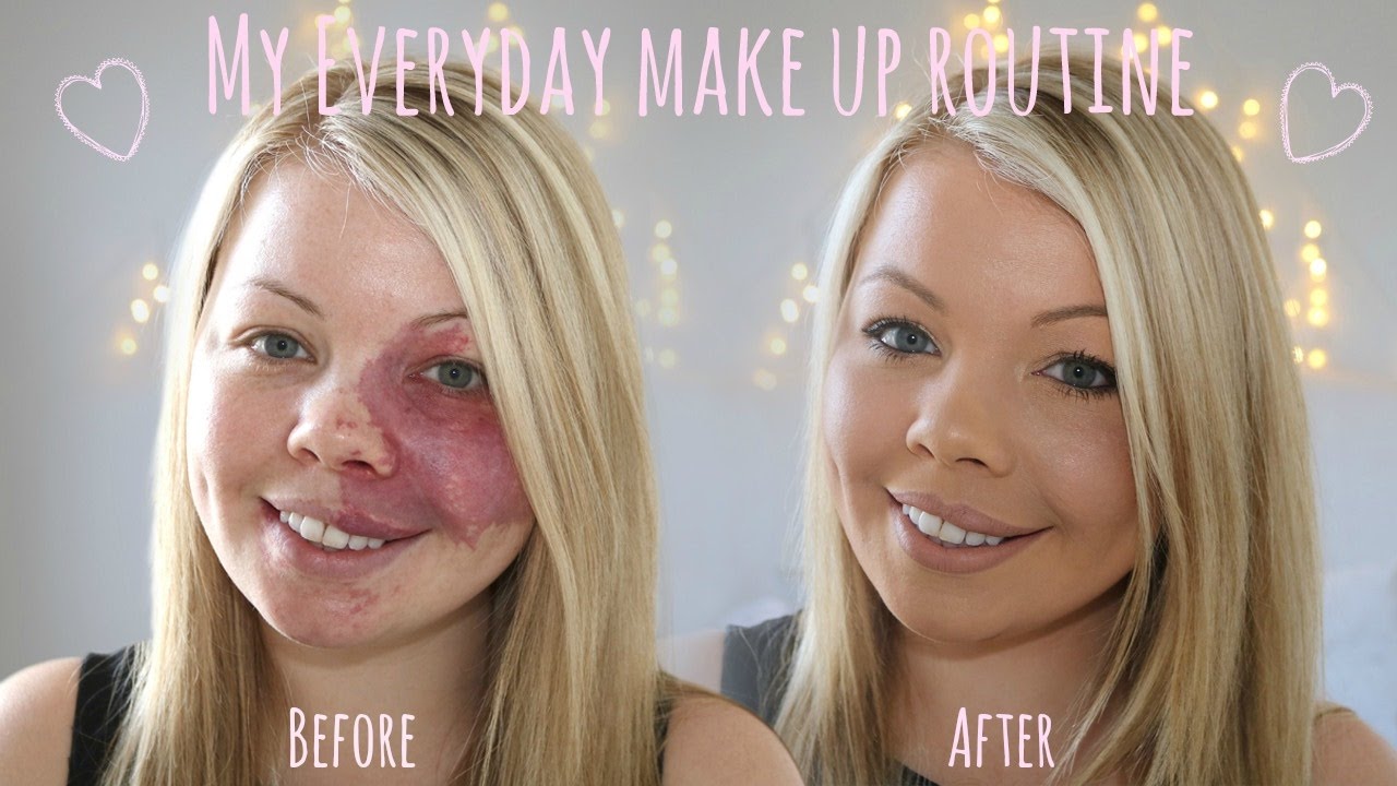My Everyday Make Up Routine | Birthmark Coverage | Amy Elsegood