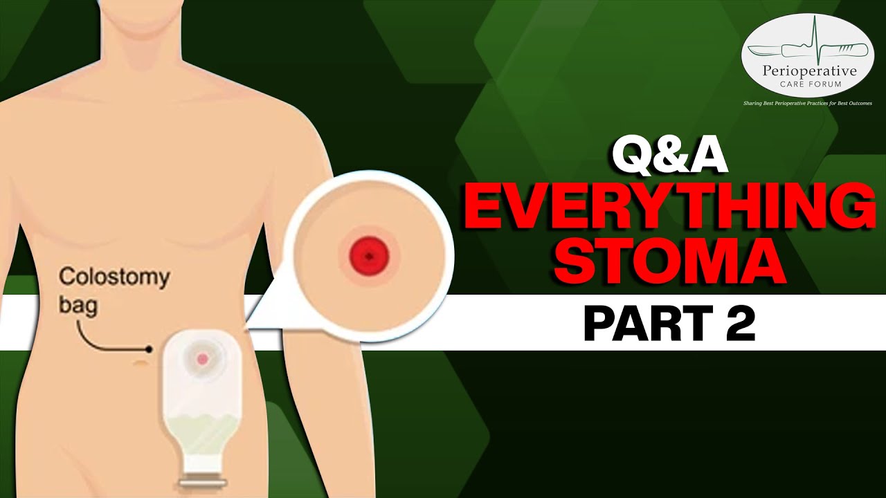 Perioperative Care Forum: Is there still a risk of IBD after ostomy surgery?