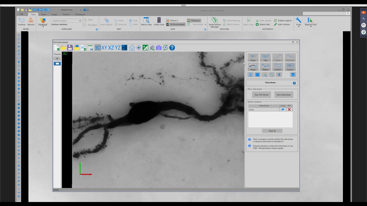 Webinar: Explore the all new Sub-Volume Tool in Neurolucida 360