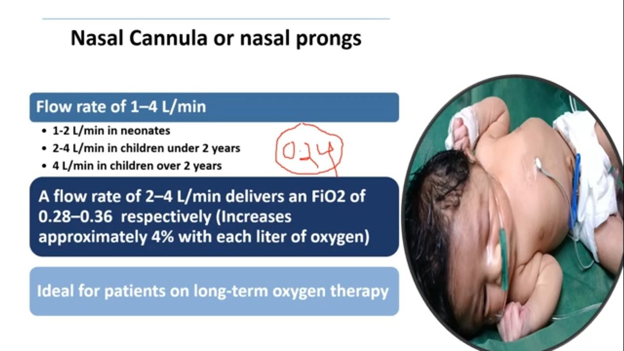 Oxygen Therapy | Pediatrics