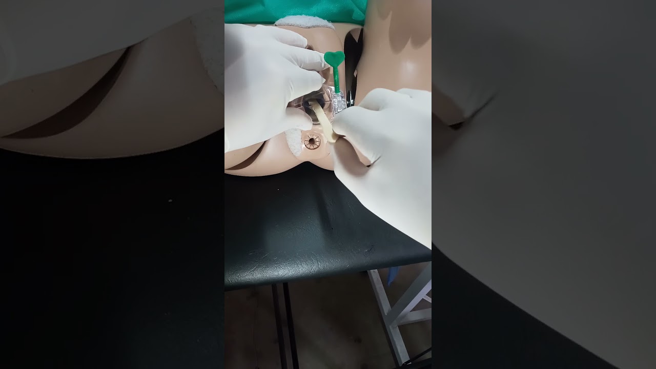Toma de muestra Cérvico-Vaginales