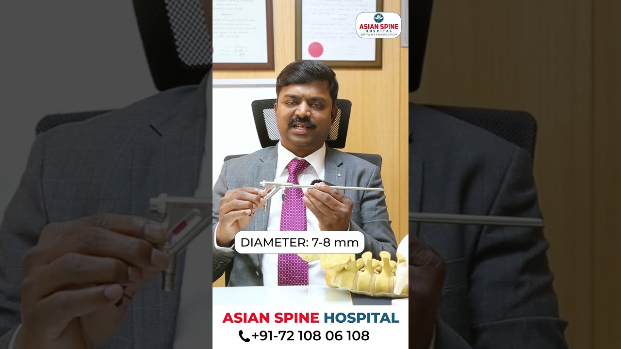 Full Endoscopic Spine Surgery | Dr. Sukumar Sura #spine #endoscopicsurgery #shorts #shortsviral