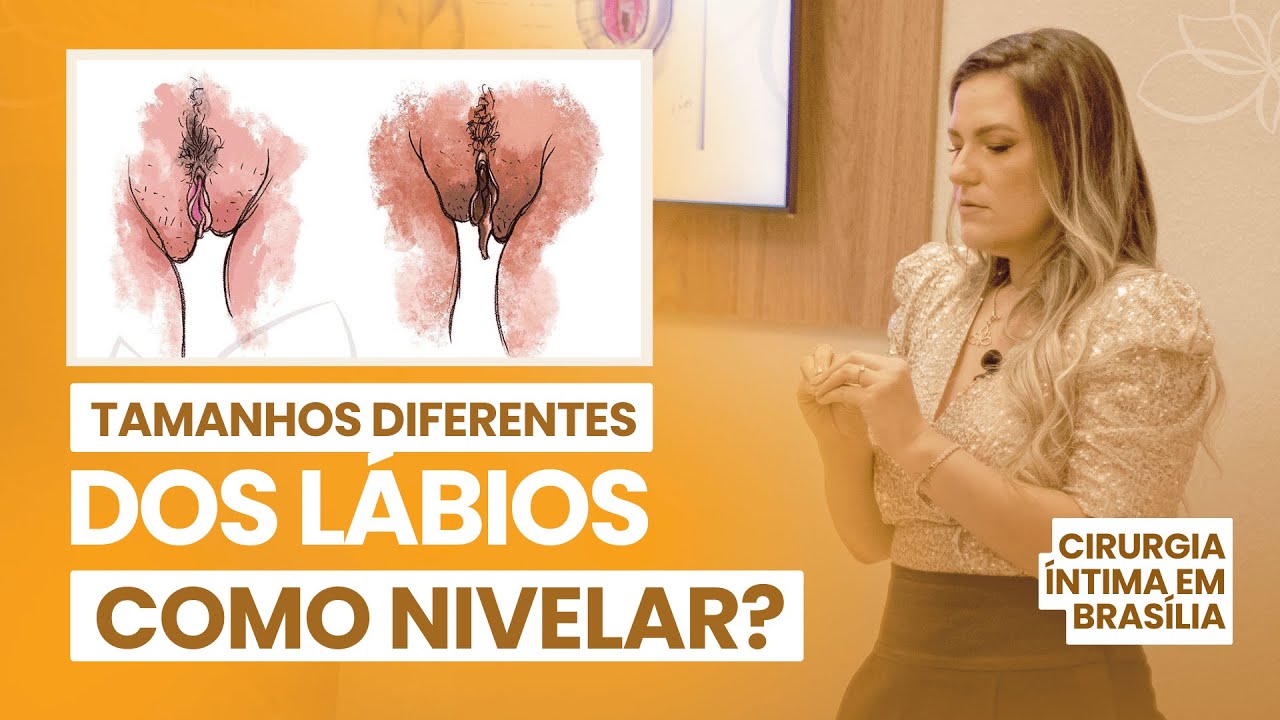 SULCOS INTERLABIAIS: TAMANHOS DIFERENTES, COMO NIVELAR? - Dra. Thalia Maia - Ginecologista