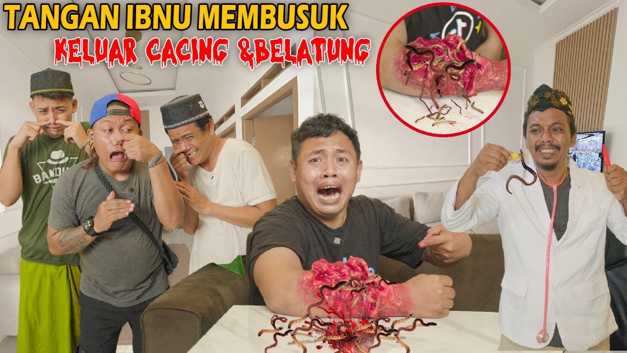 TANGAN IBNU BENGKAK DAN MEMBUSUK DI PENUHI CACING & BELATUNG
